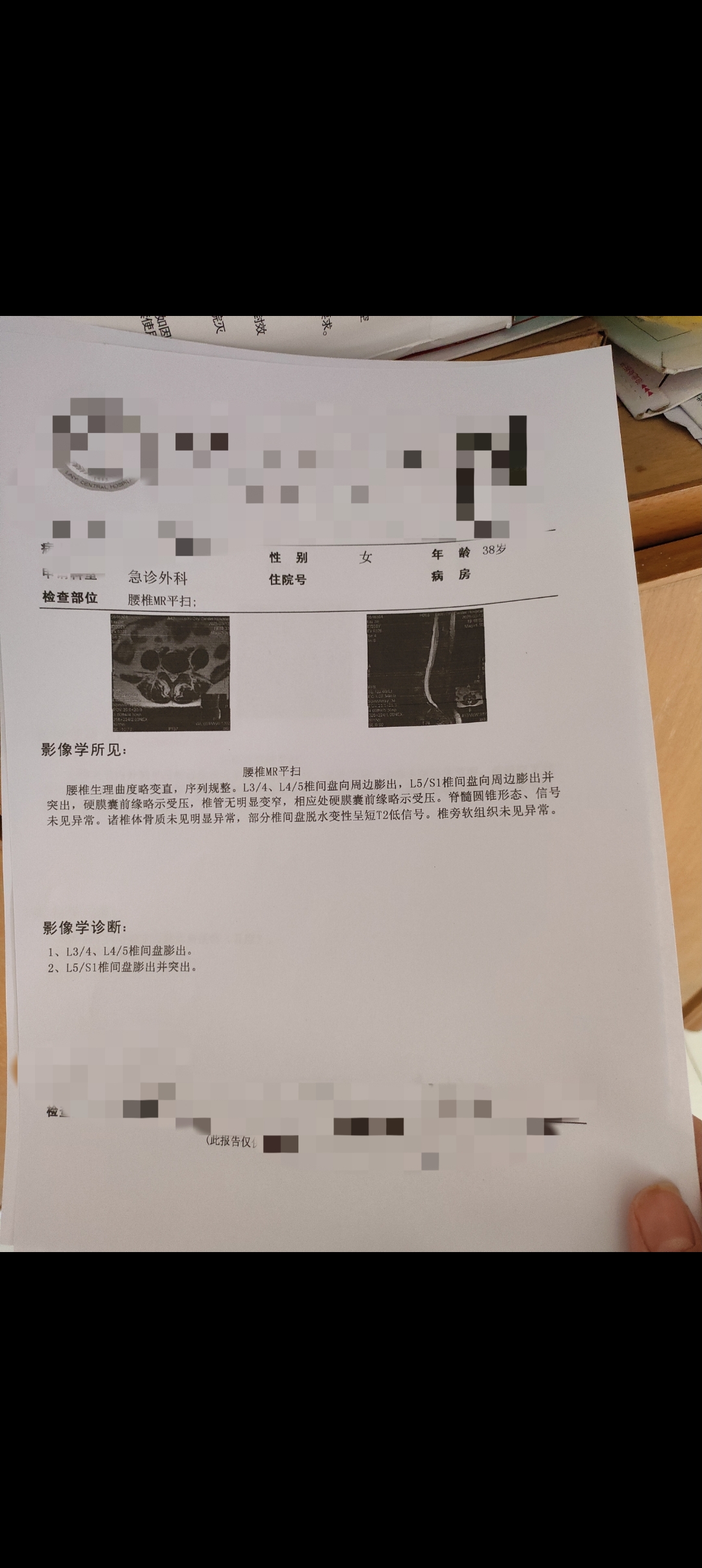 309医院专家挂号核磁加急-301医院预约了核磁,暂时去不了怎么办 