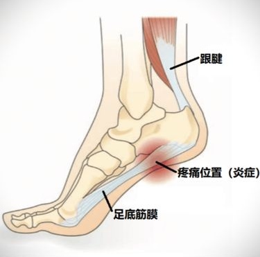 脚窝的位置示意图图片