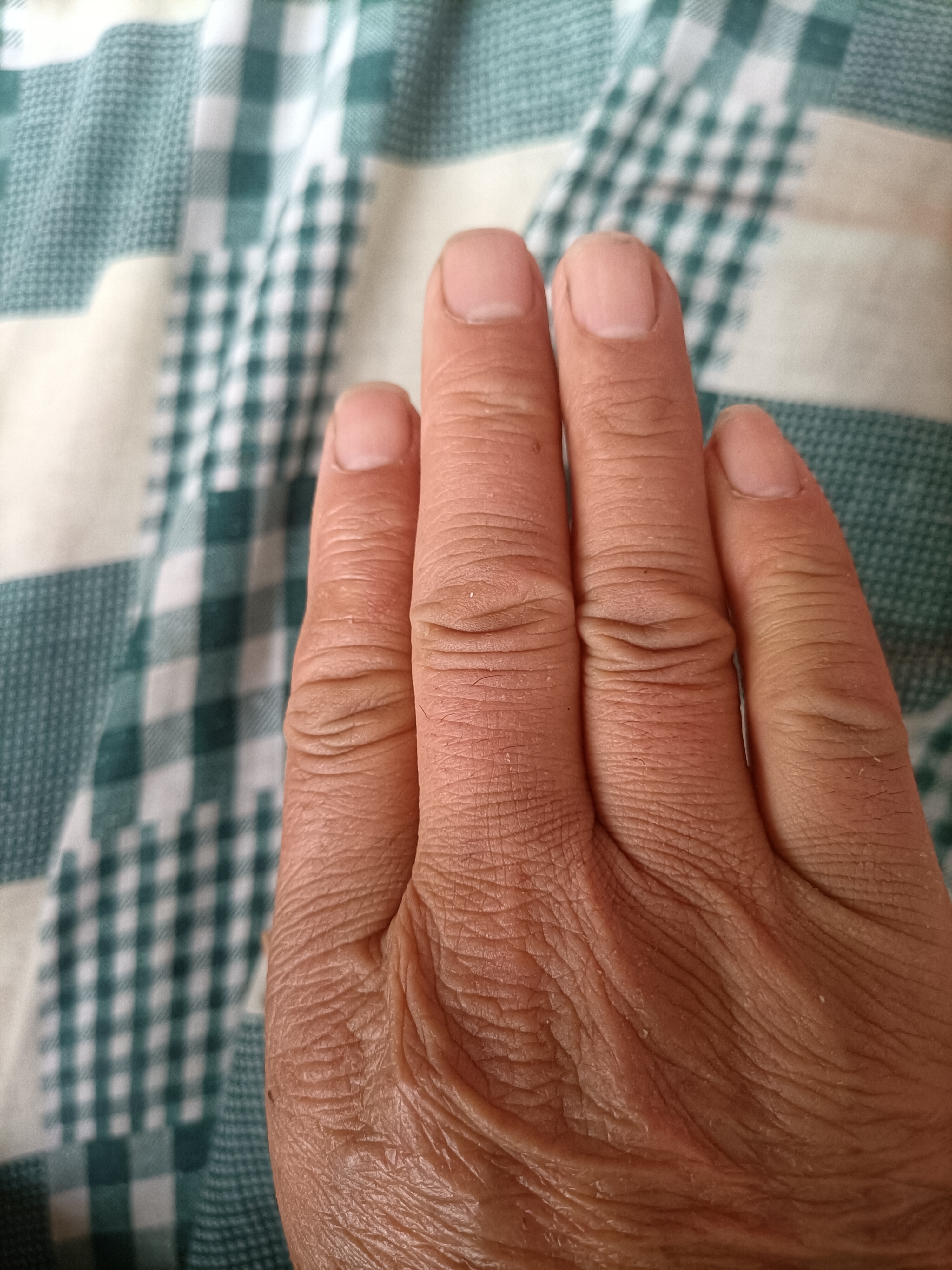 两只无名指都比食指长,两只脚上都有一颗太阳胎记,十根手指全是簸箕