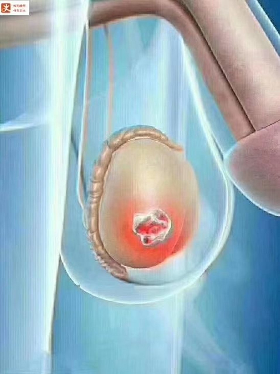 平常我们说闲的蛋疼,是怎么回事  当男性出现蛋疼时,一般分为两种情况