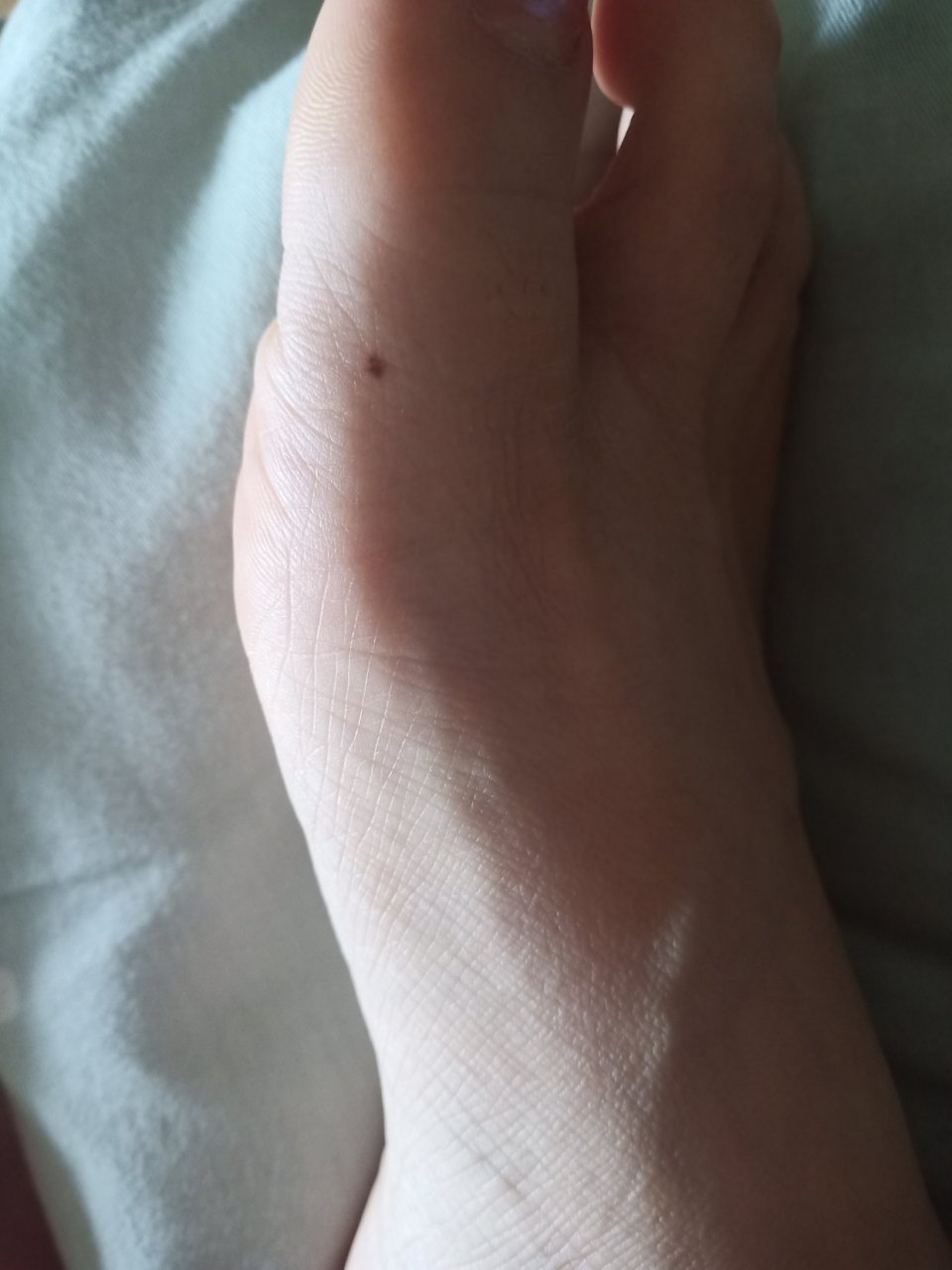 有没有大师,可以帮我看一下脚拇指上这个位置有痣好吗?