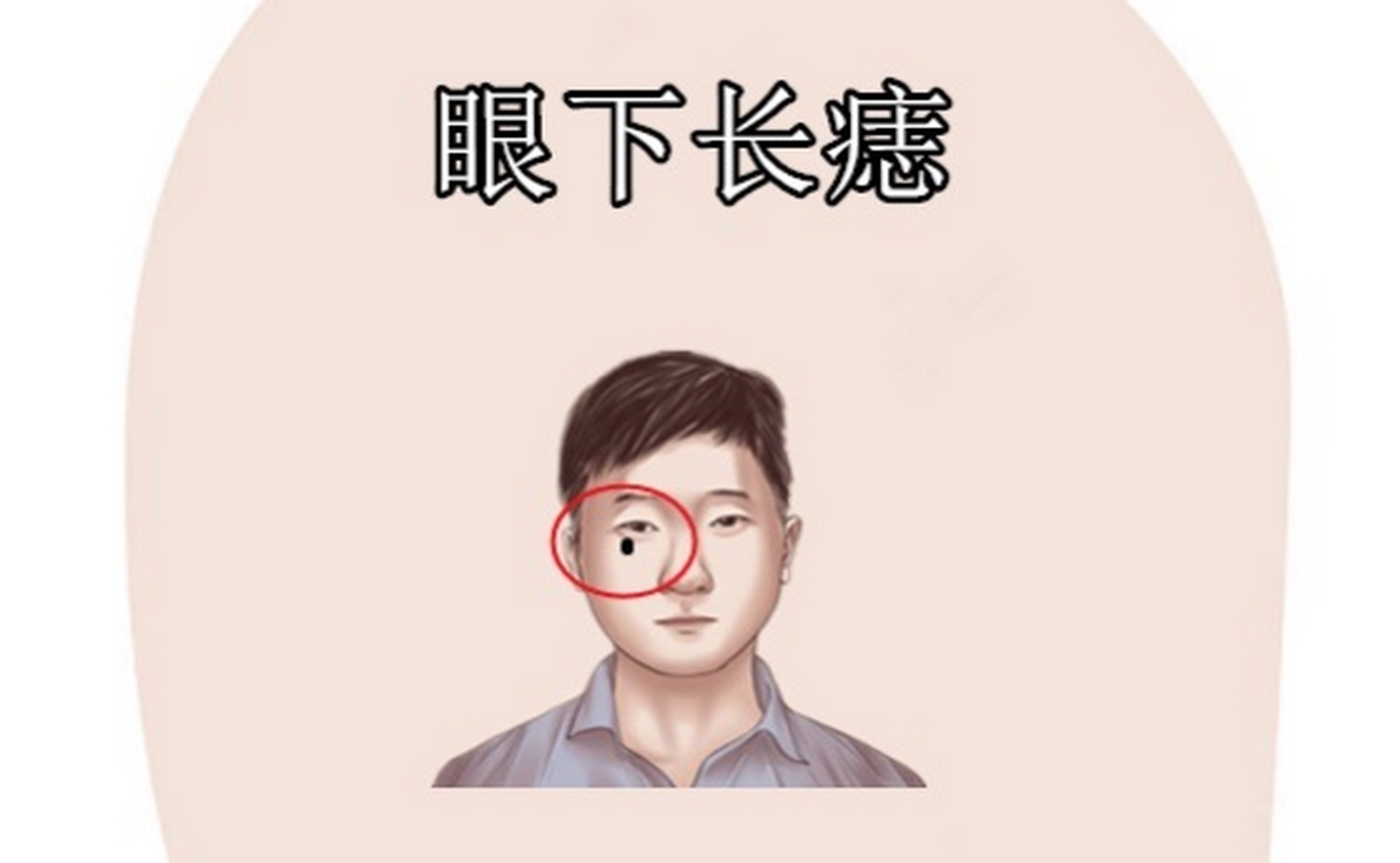 面相识人术:眼下长痣 在相学当中,眼下就是我们所说的子女宫的位置