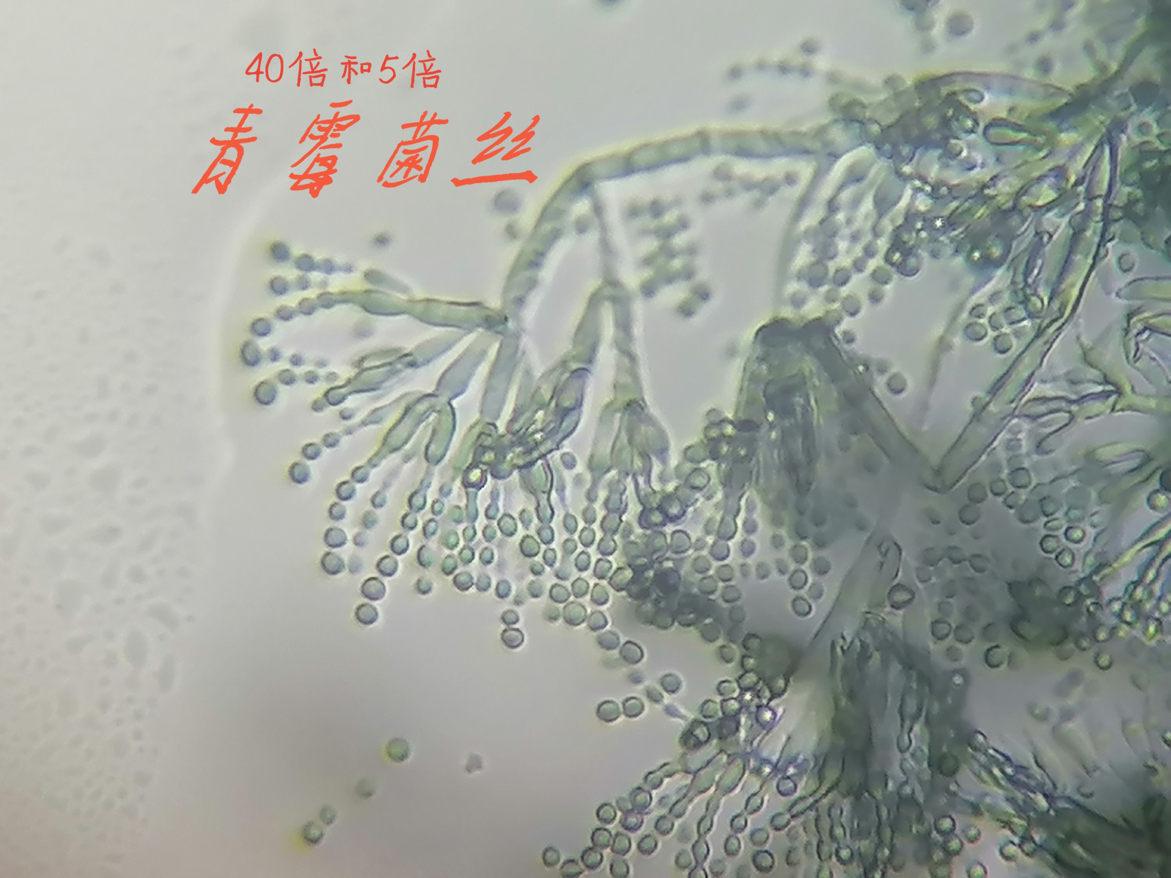 40倍镜下青霉菌丝压片