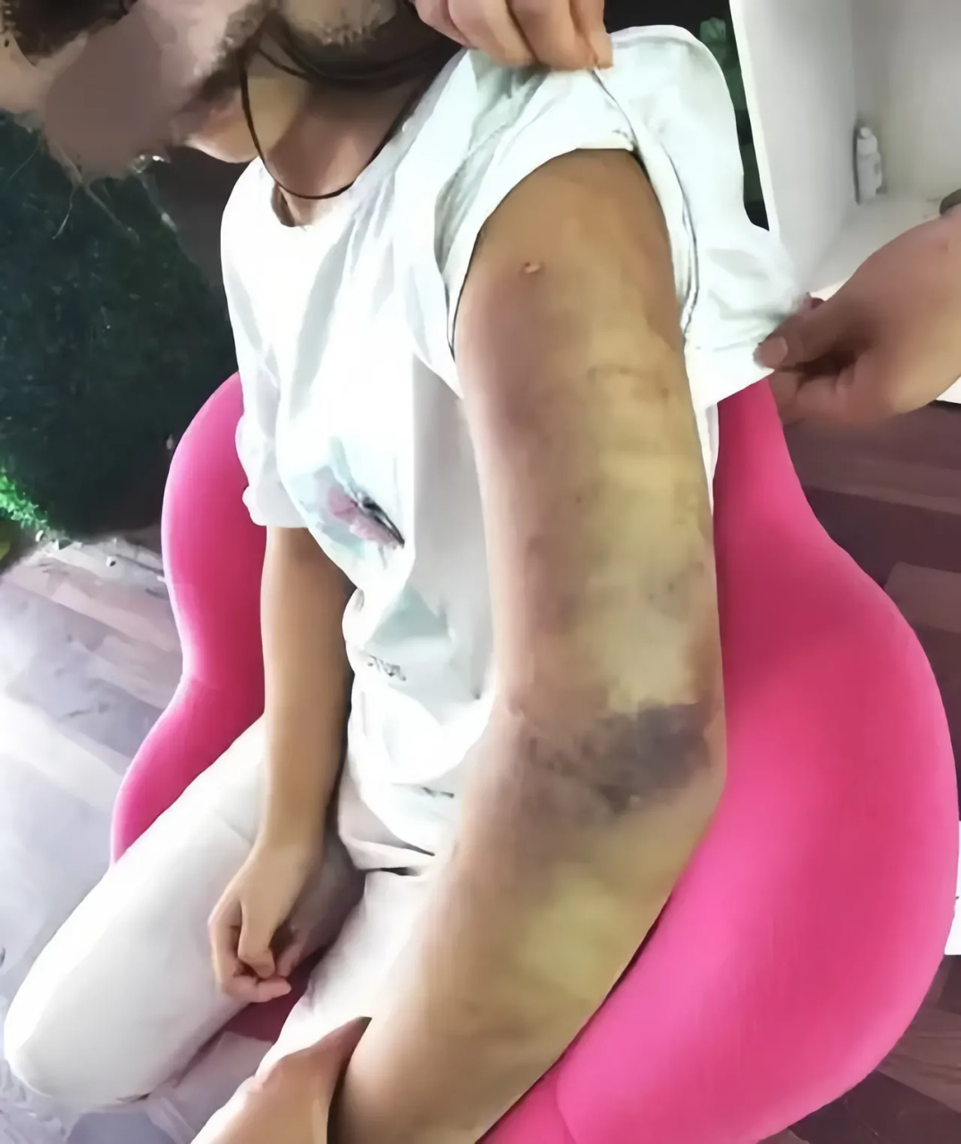 江西南昌,一个不到7岁的小女孩被继母打得遍体鳞伤,哭着不敢回家,躲到