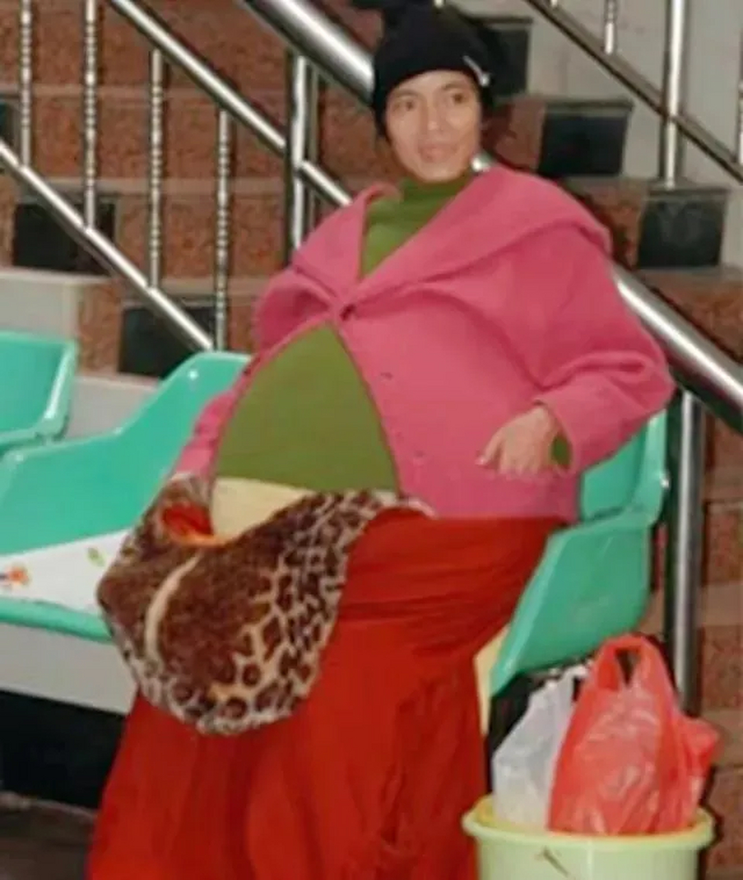 "广东,一女子怀胎12个月仍未有要生的迹象,到医院检查后发现,肚子里竟