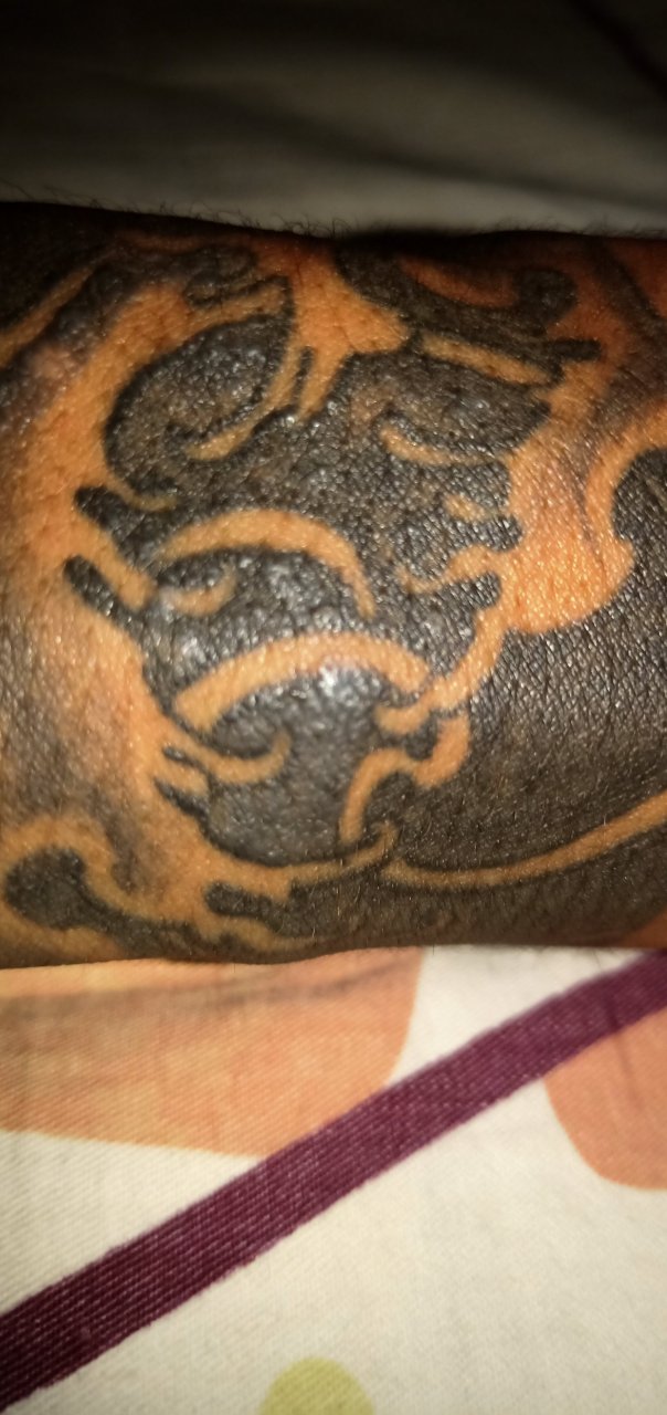 纹身半年多了,是不是过敏了好痒 红霉素软膏用了没作用  什么药好啊