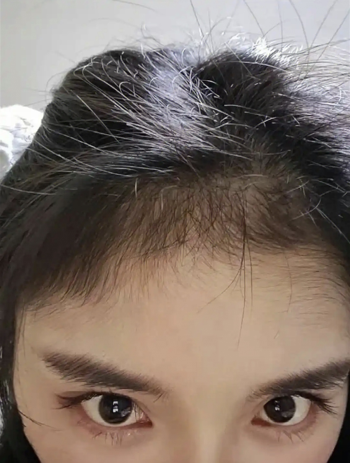 有些人在前额上方有一些稀疏的像绒毛一样的头发,这种额型对婚姻不利