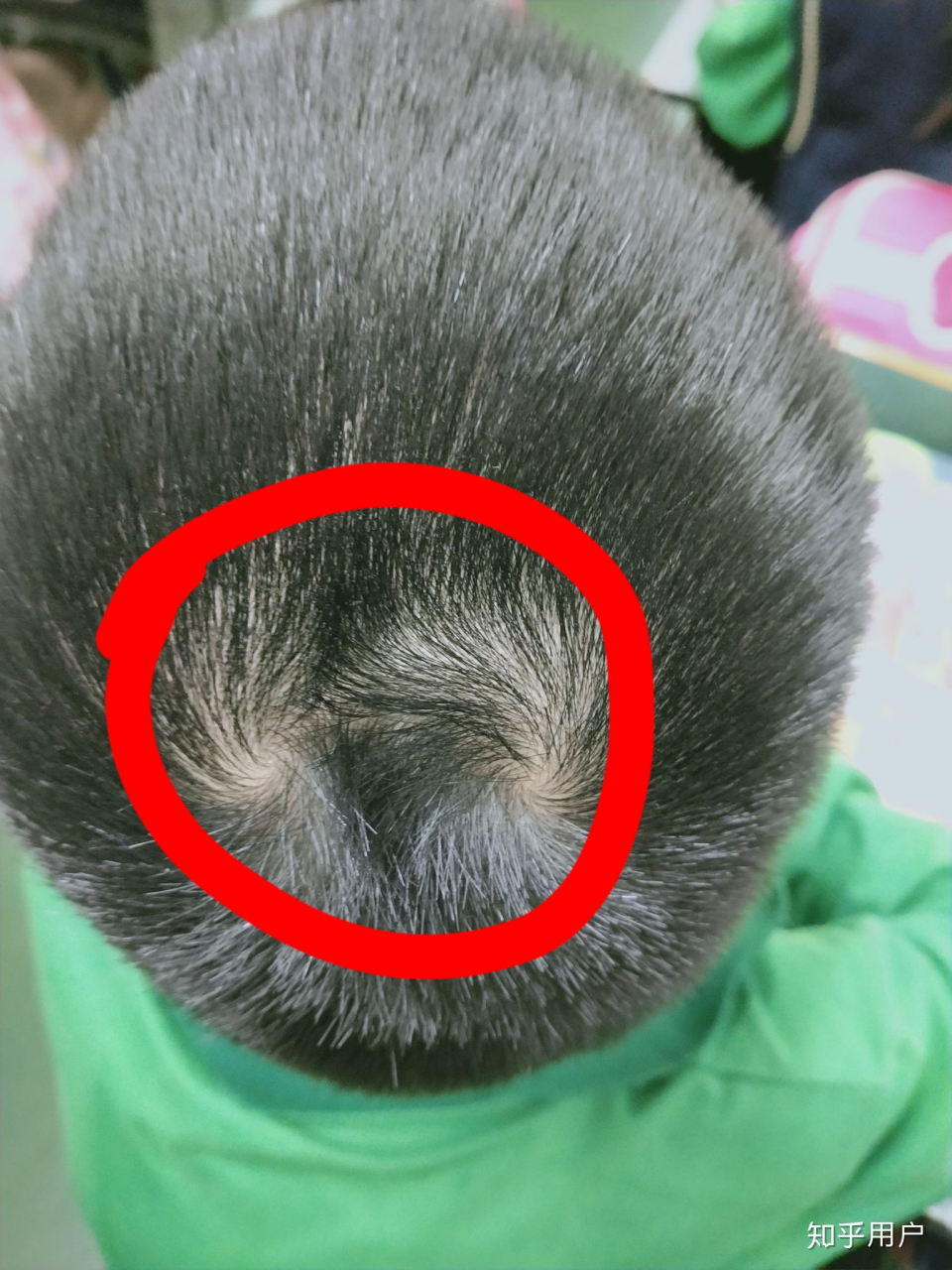 一旋代表聪明,悟性高,二旋则被认为是不吉利的象征,预示着孩子将来