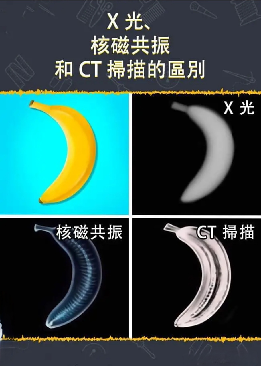 一目了然的x光,ct,核磁!