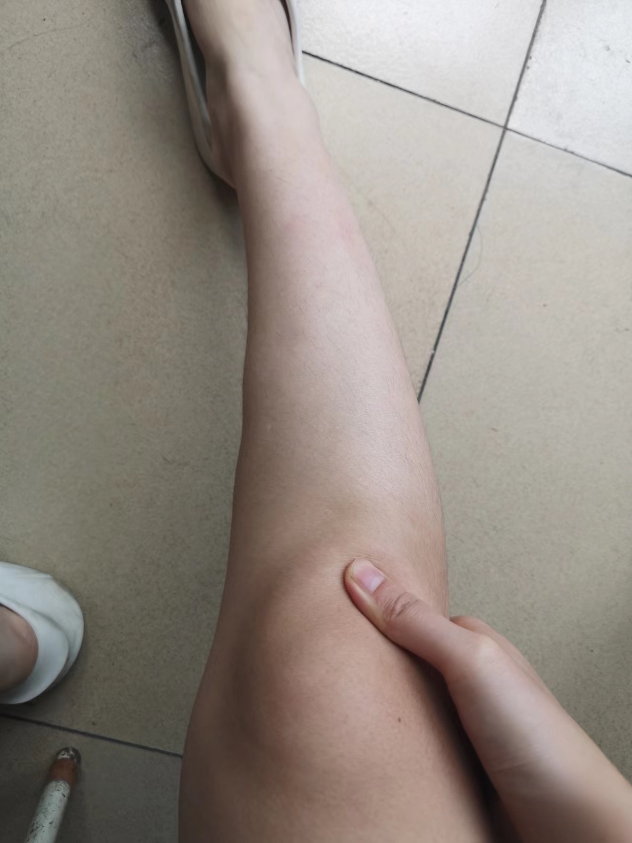 半月板损伤与康复# #膝关节半月板损伤