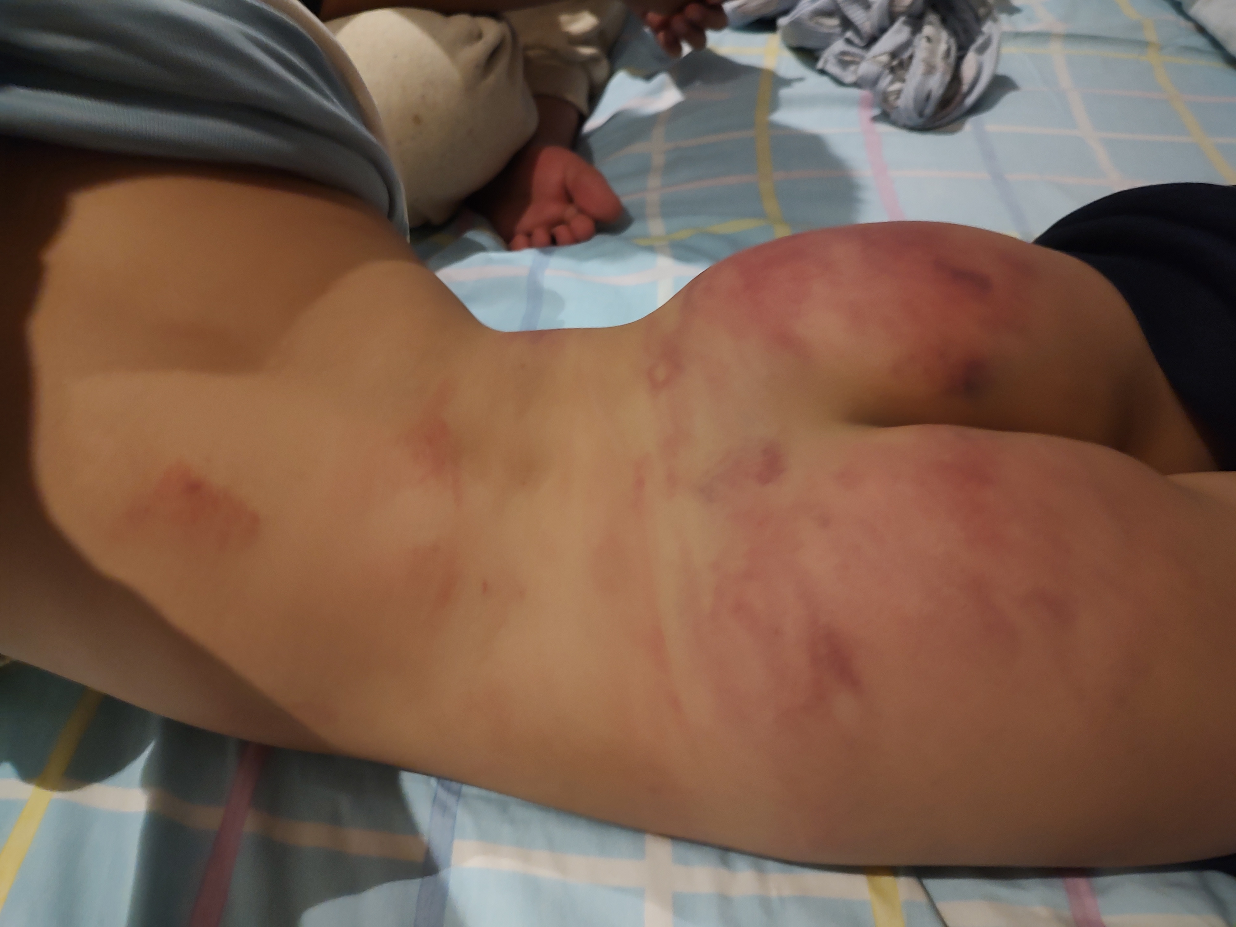 一家人到广西桂林玩,因孩子和大人生气外跑,找到后被父毒打惨不忍睹