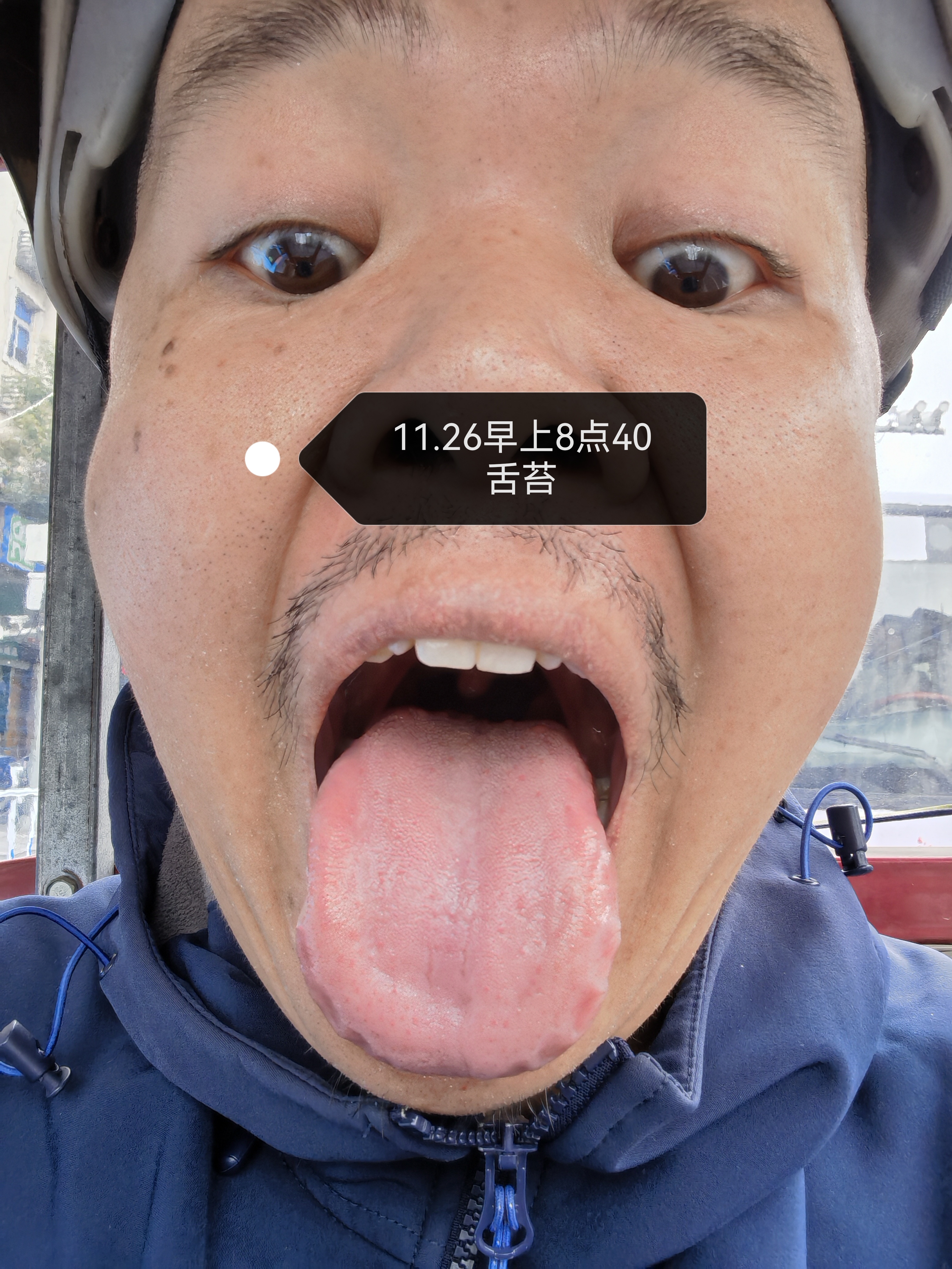 在京东互联网医院看病的经历 因为吃药引起肝胆湿热等