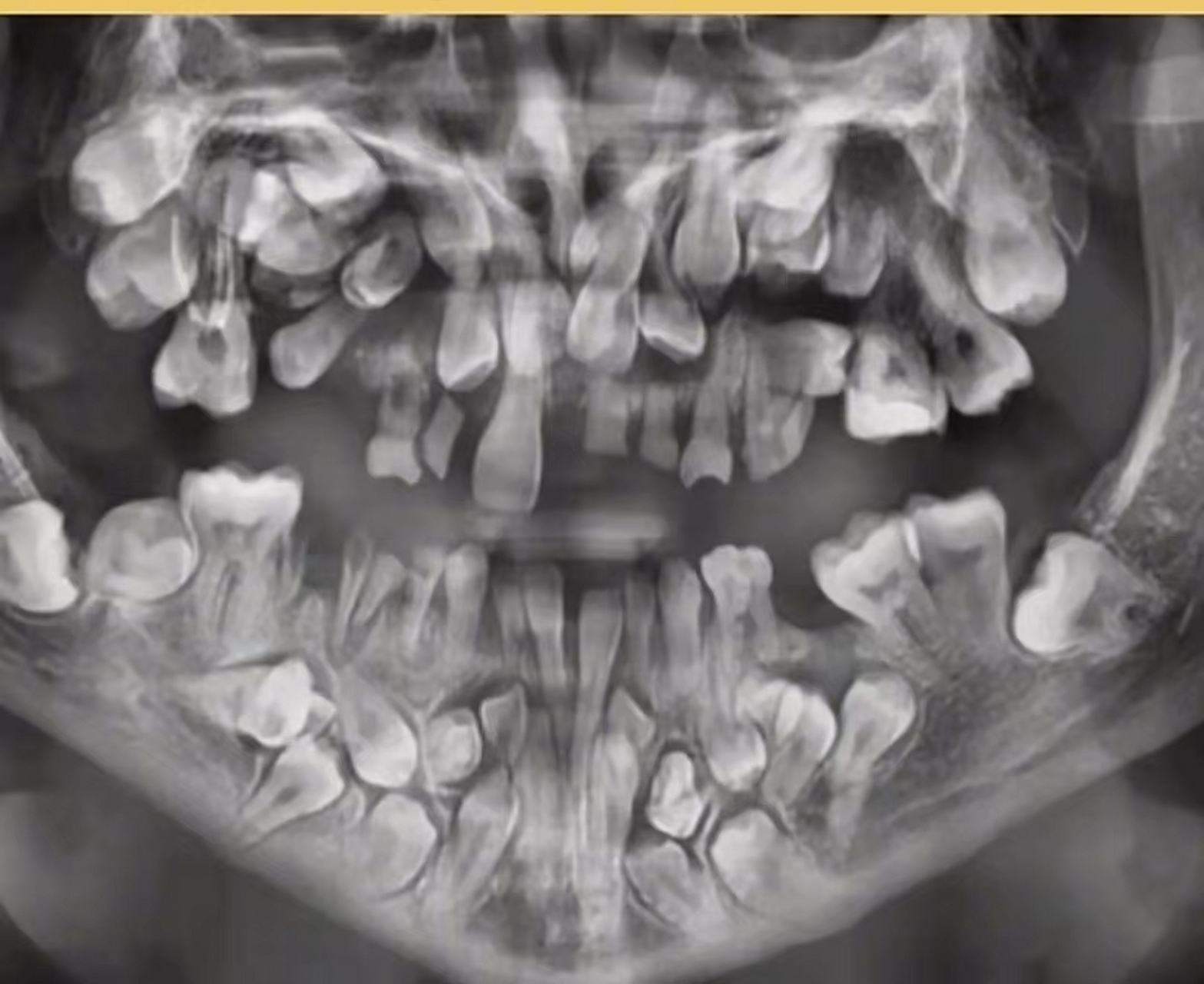 网友:"满口都是牙",医生看了都直摇头.