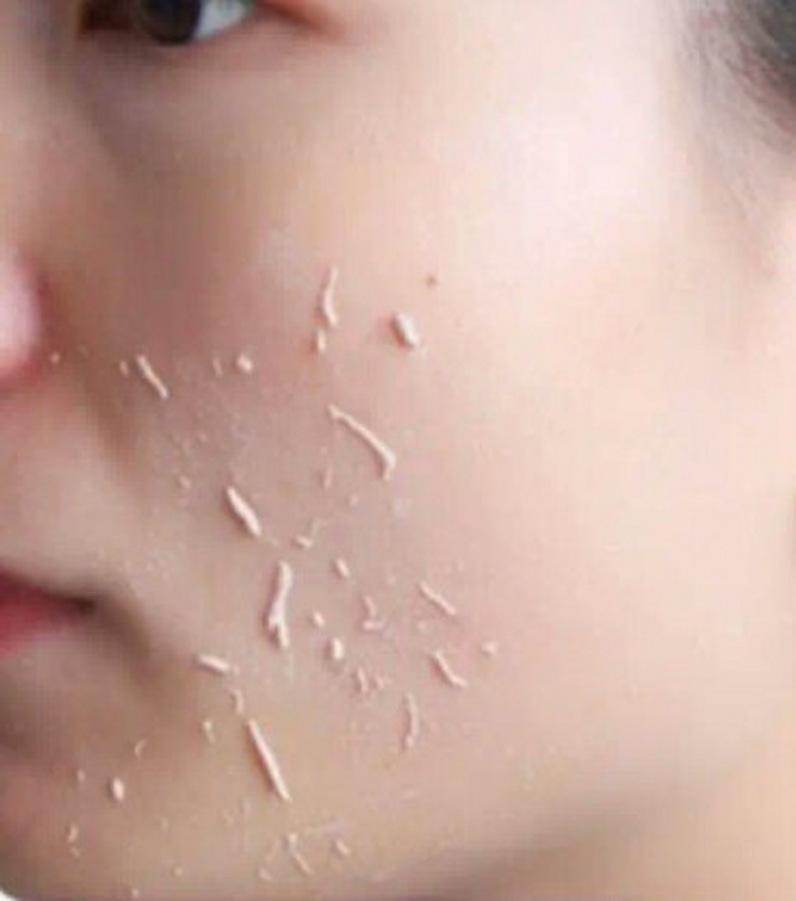 要去除面部角质死皮的主要原因