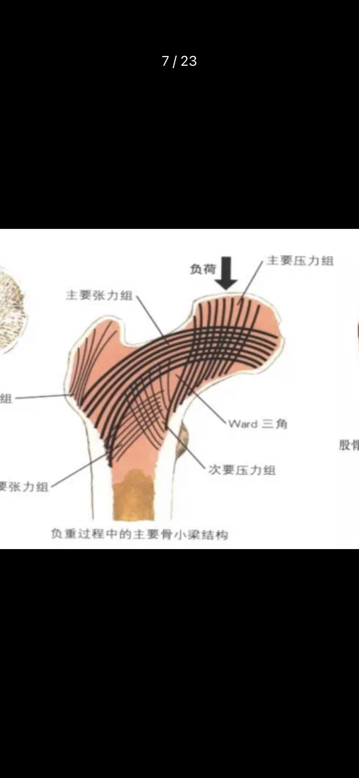 骨小梁中断图片图片