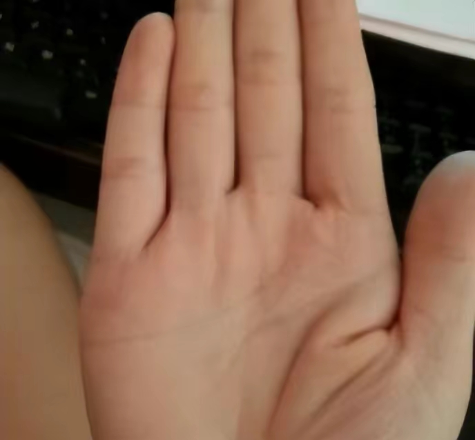 巽宫代表财富,如果有玉井纹就说明你有很好的财运,如果有多个玉井纹