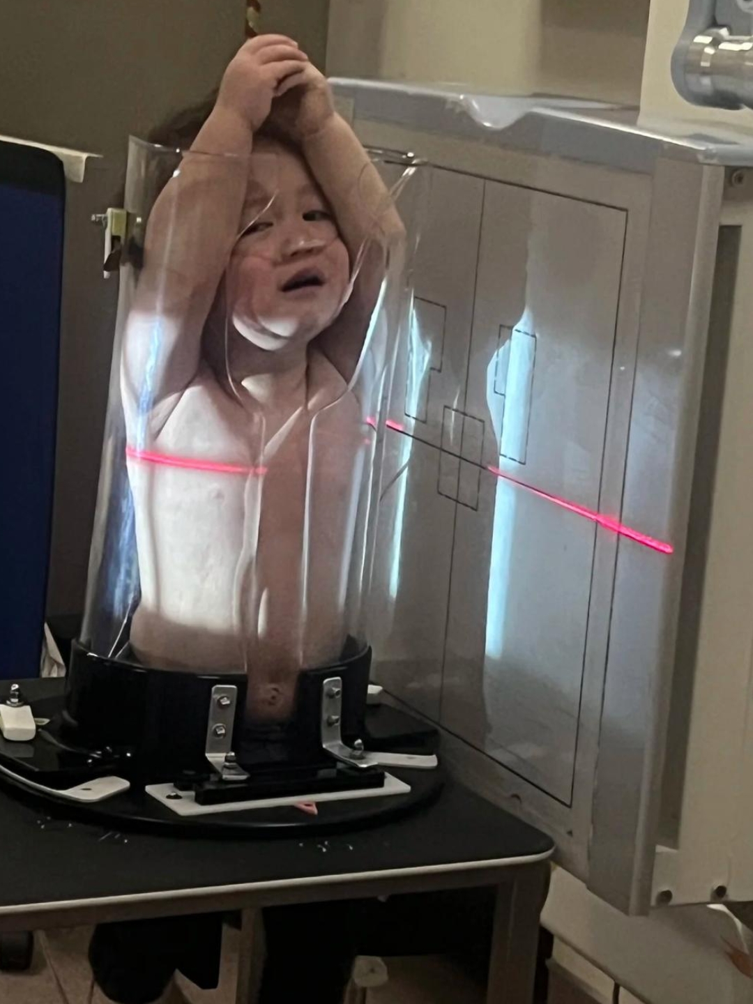 第一次看到给婴幼儿做x光片要放到玻璃容器里,这样子放进去,孩子会不