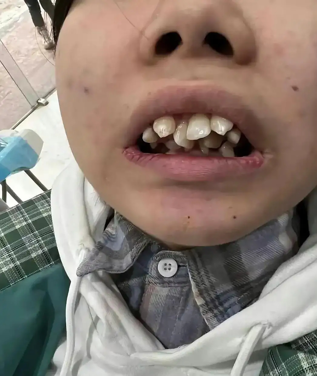 这是长了三排牙齿吗?给咬一下还得了吗?