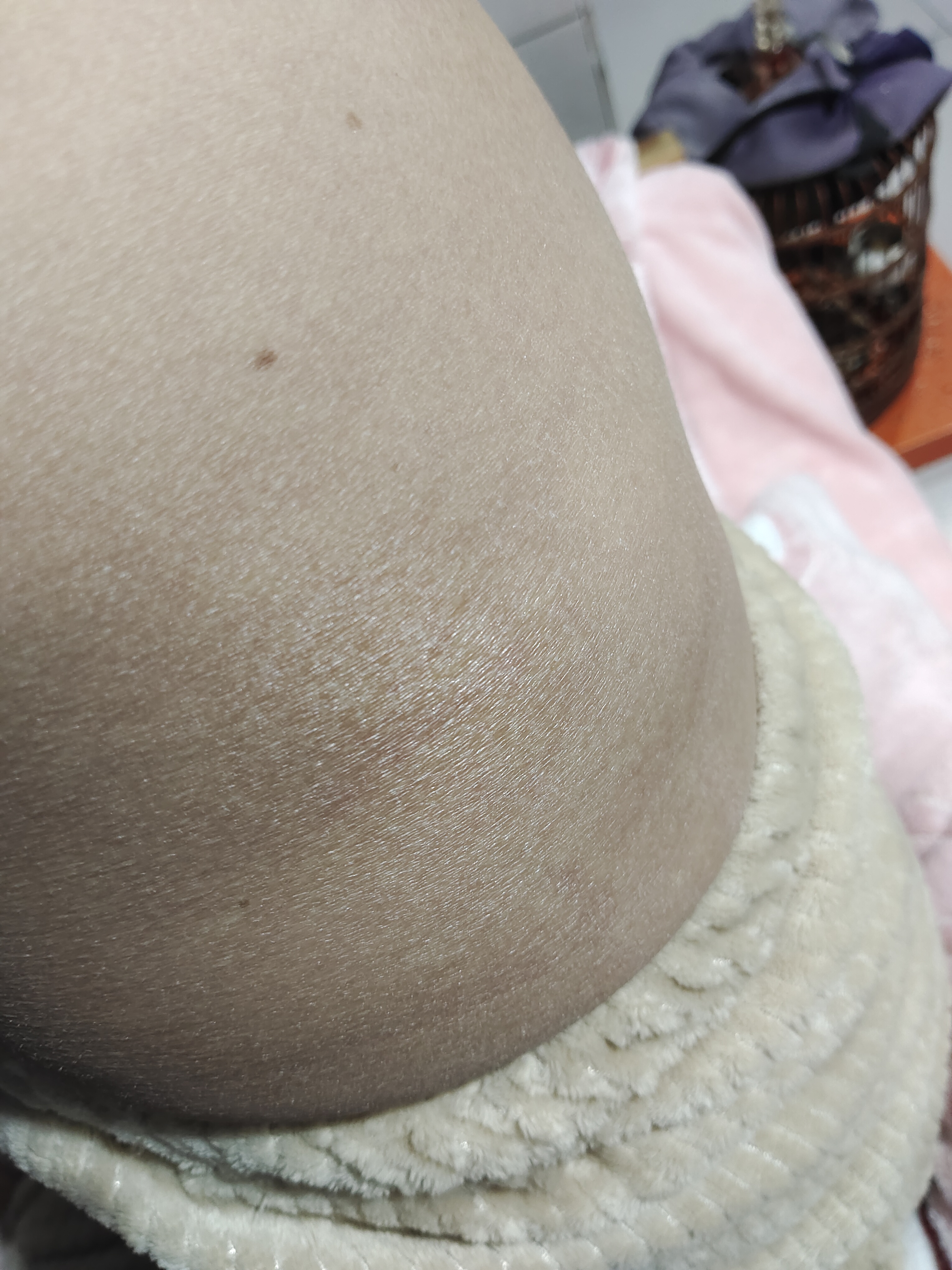 肚子小腹腰周围都是这样的是怎么回事干燥起皮,皮肤一点都不好,该怎么