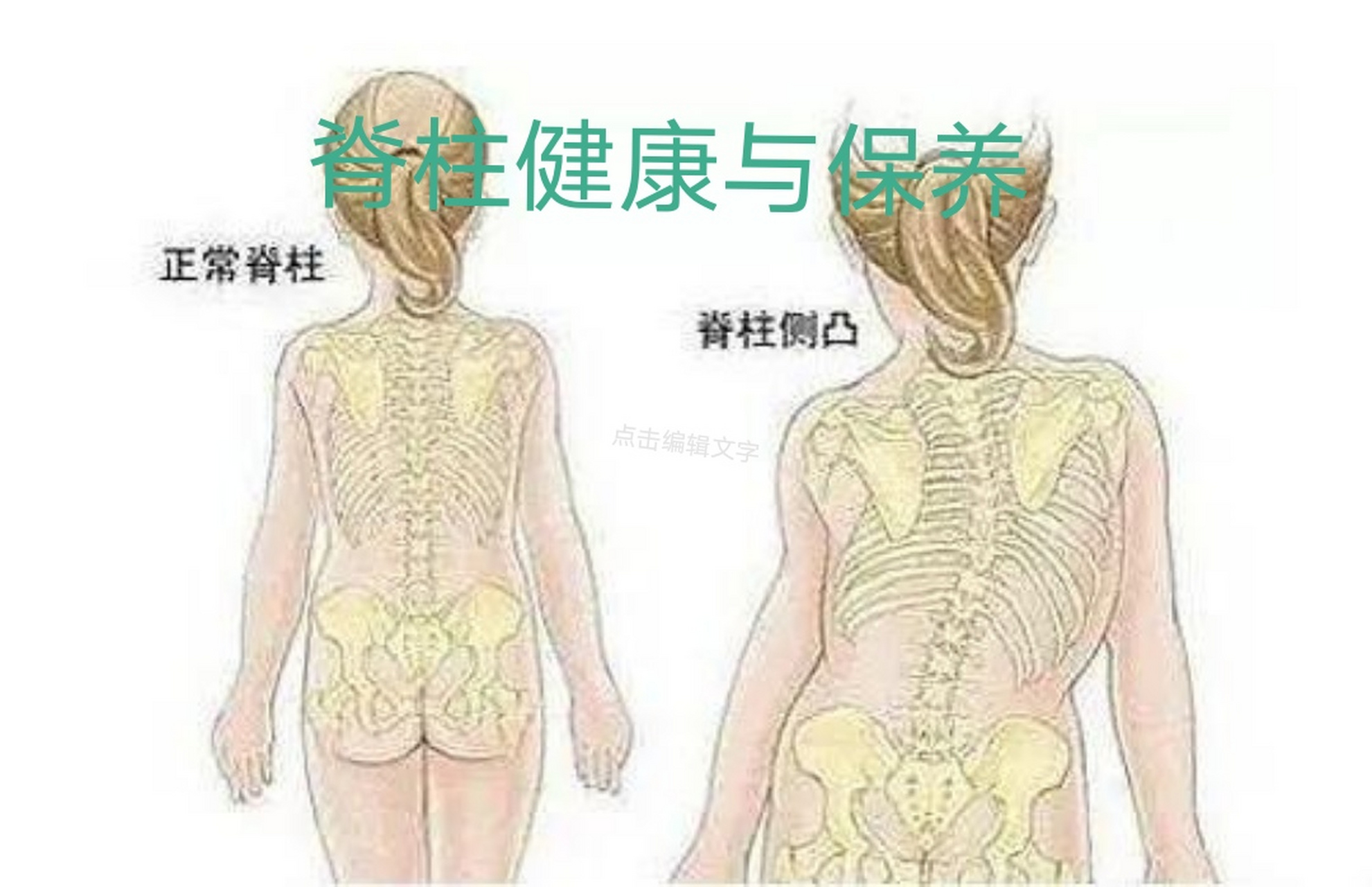 健康知识 脊柱是人体的中柱,也是人体的交通要道,它的健康关乎全身