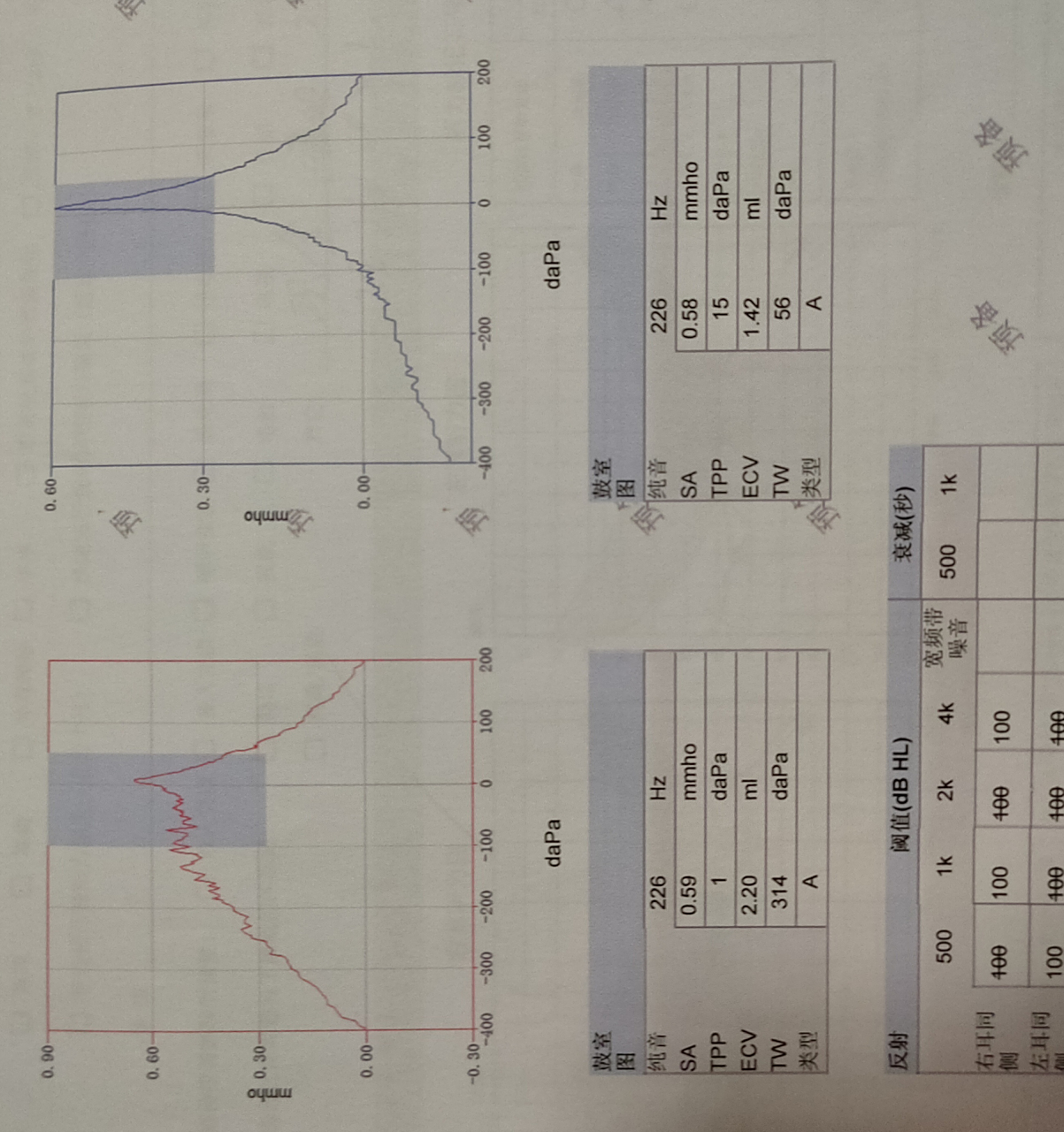 这个鼓室图谁帮我仔细解答一下呗,谢谢