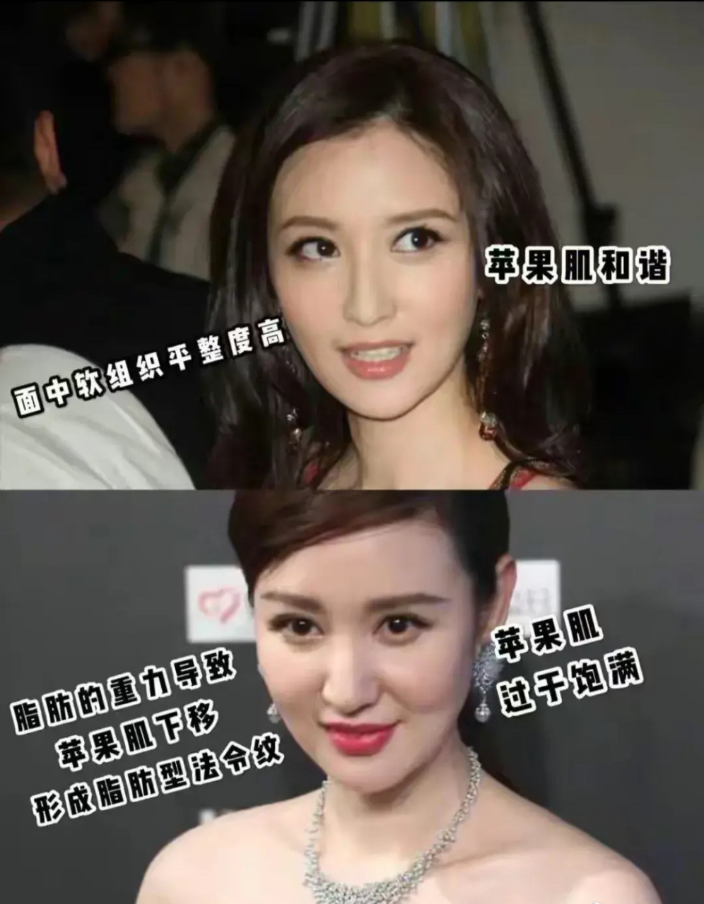 张萌为什么想不开要去整容呢?原来多美啊