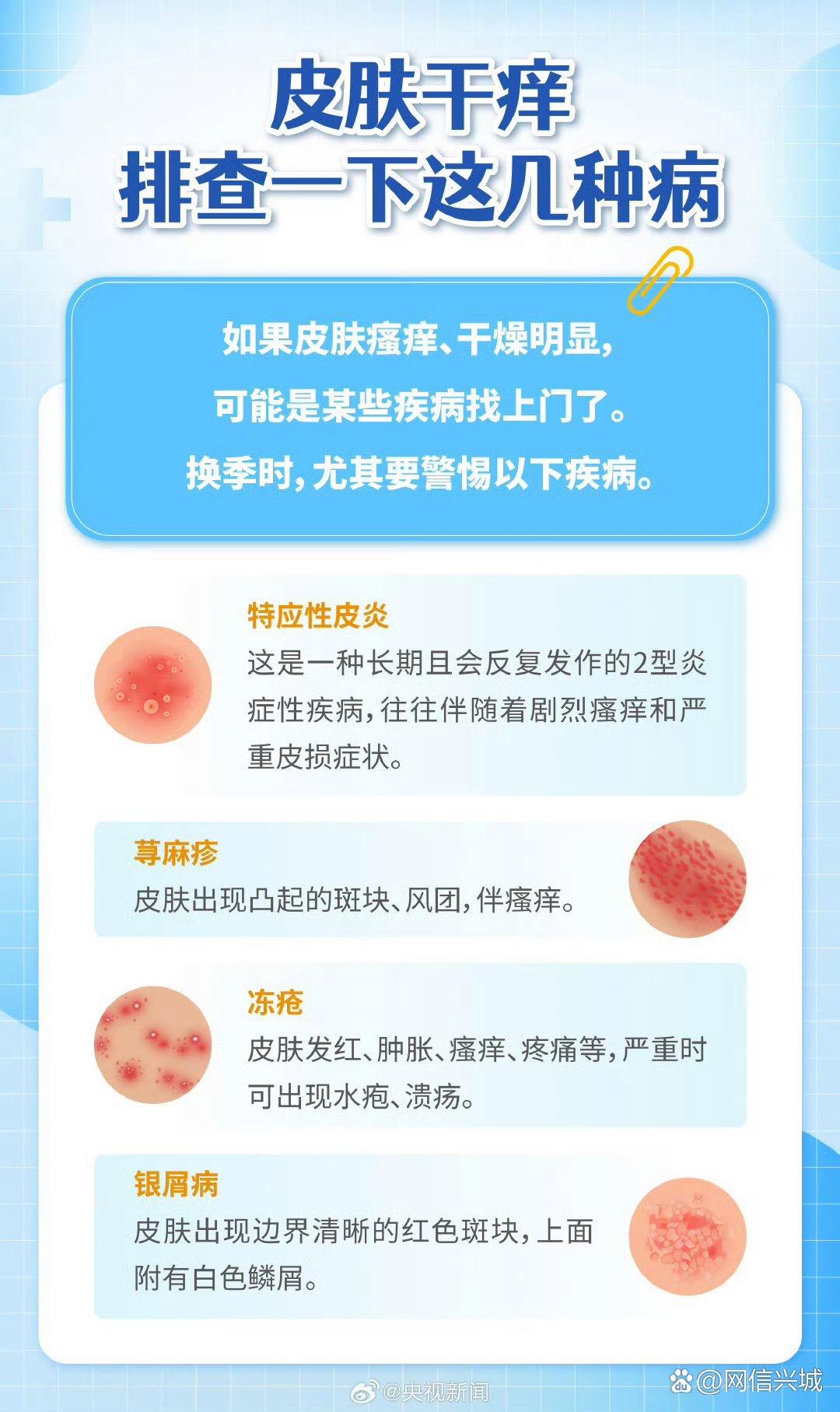 天气热身上痒怎么回事今日情况 天气热身上痒怎么回事今日情况