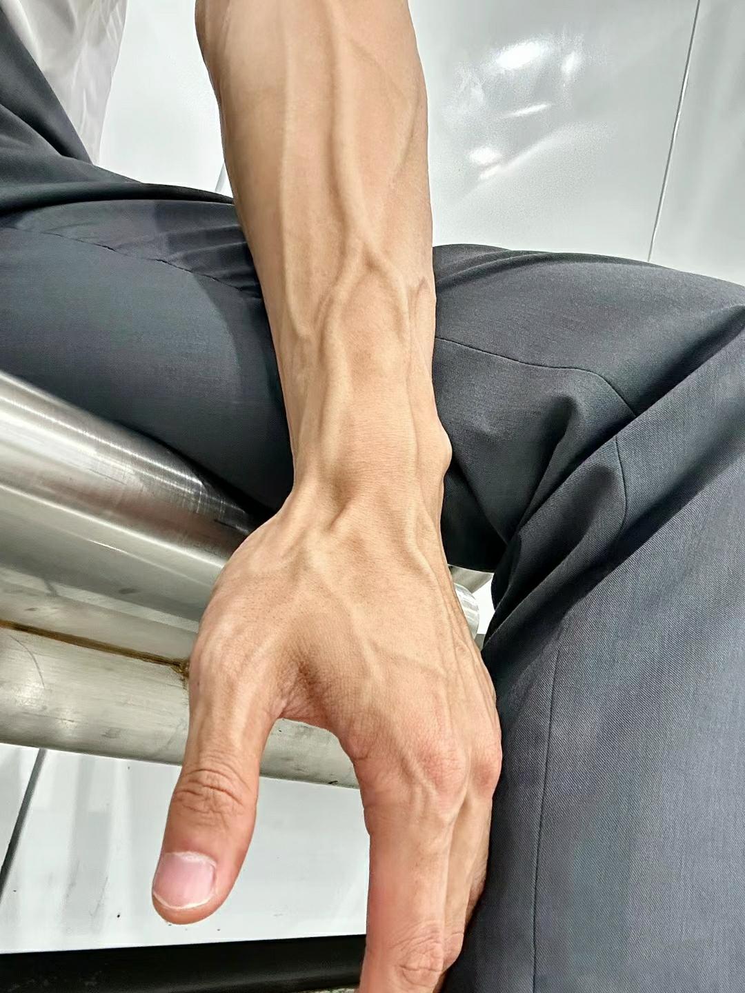 我就想问一下,你们当护士的是不是都喜欢我这样的手臂啊 血管清晰可见