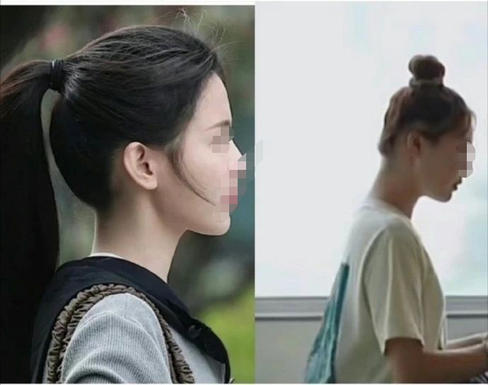 这就是圆头跟扁头的差别吗?我就是扁头.
