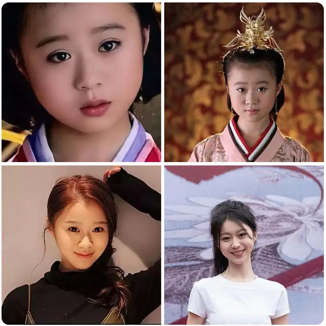 尤其腮帮子那块儿,看美人心计董慧董慧小时候董慧现在的照片董慧小