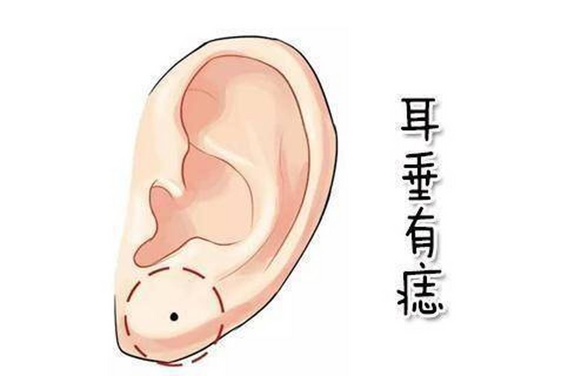耳垂有痣你知道代表什么吗?