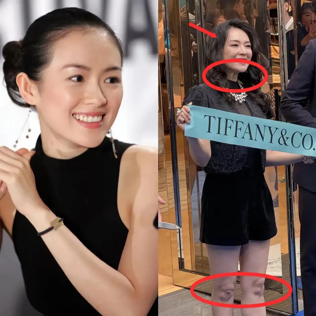 听说他俩当年分手