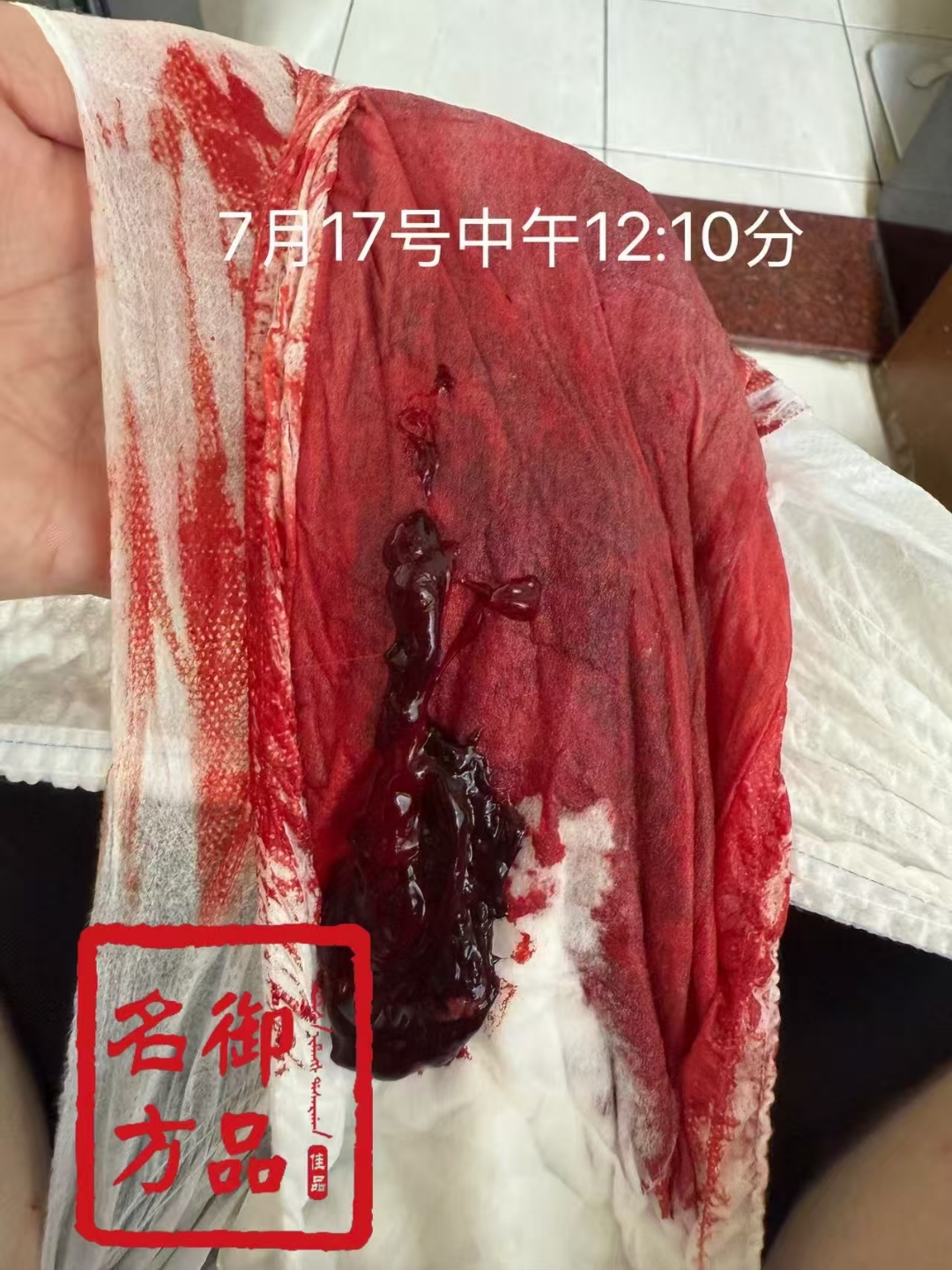 来说自己没有任何妇科问题的看过来