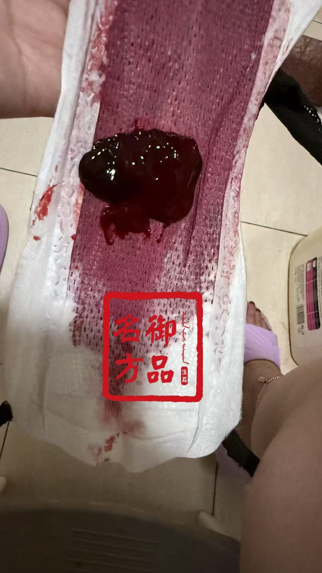 来说自己没有任何妇科问题的看过来