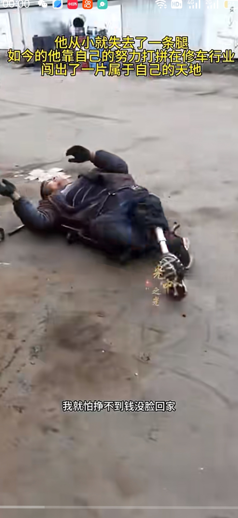 他虽折损一腿,命运的天平陡然倾斜,但心中那团炽热的火焰从未熄灭