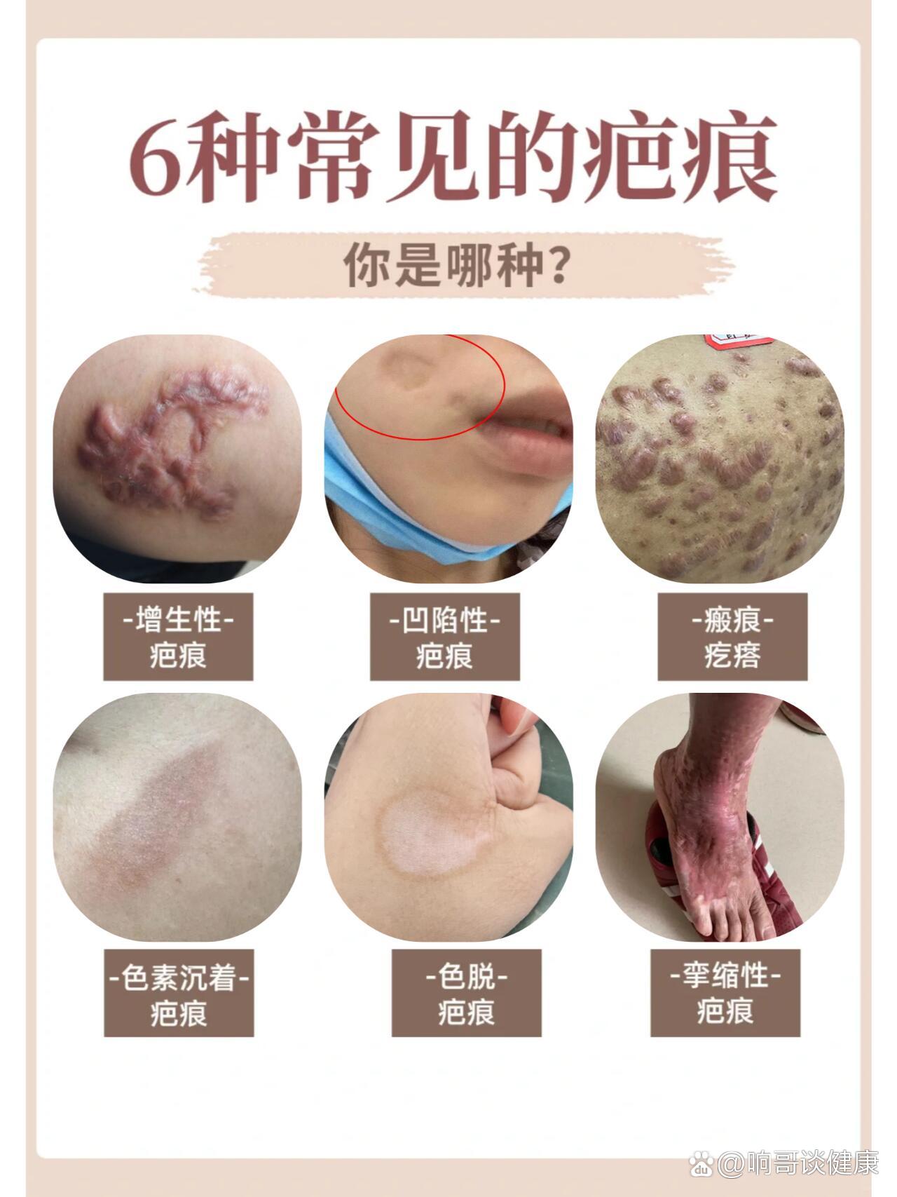 的治疗需要根据其类型,严重程度和个人体质制定个性化方案