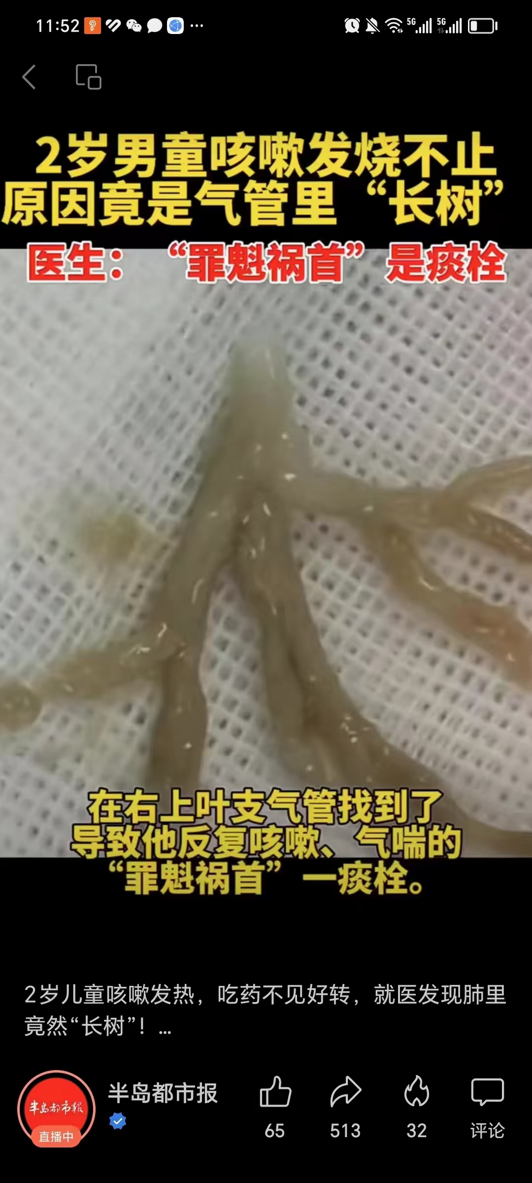 肺排.排出肺里的痰栓!