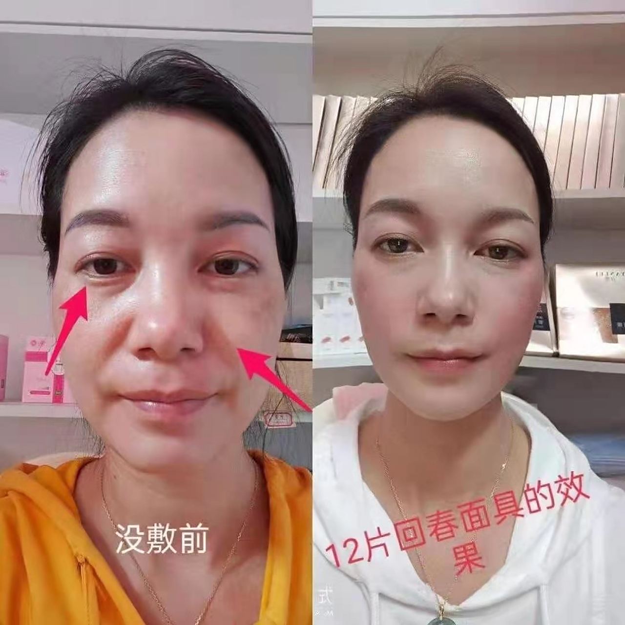 团队广东美女自用12片言蕾回春面具,变化非常明显!