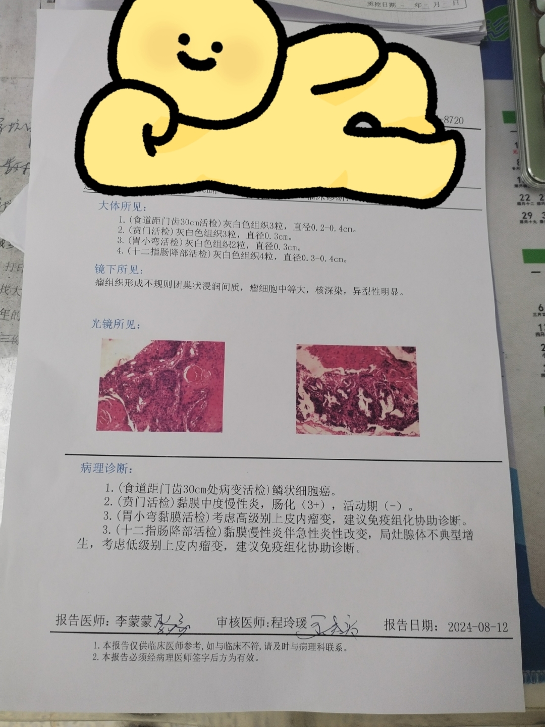 食道癌病理报告图片