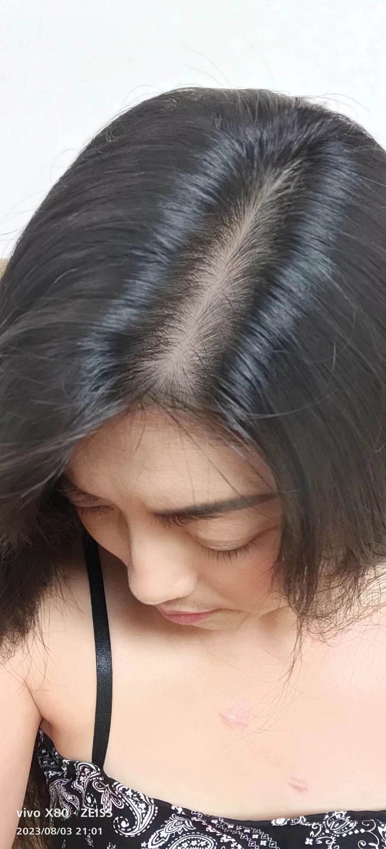 有没有像我这样的头发,发缝宽