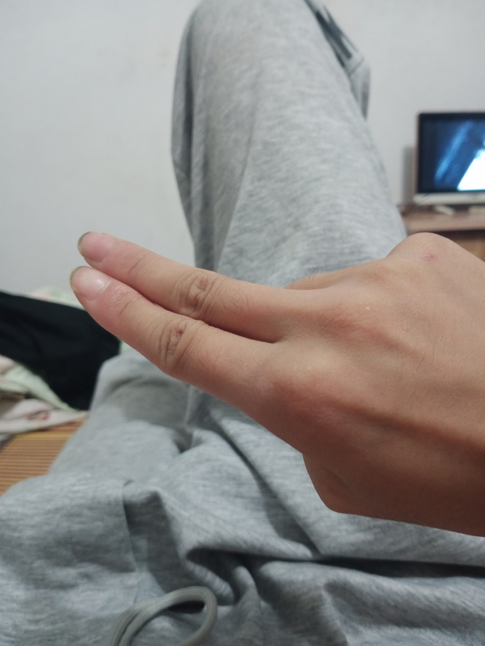 这是不是发丘指