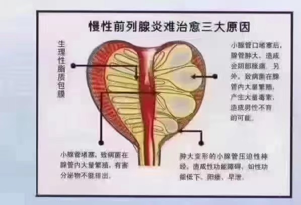 哈尔滨冰江男科医院哈尔滨男科 气温降低后,全身血液循环变慢