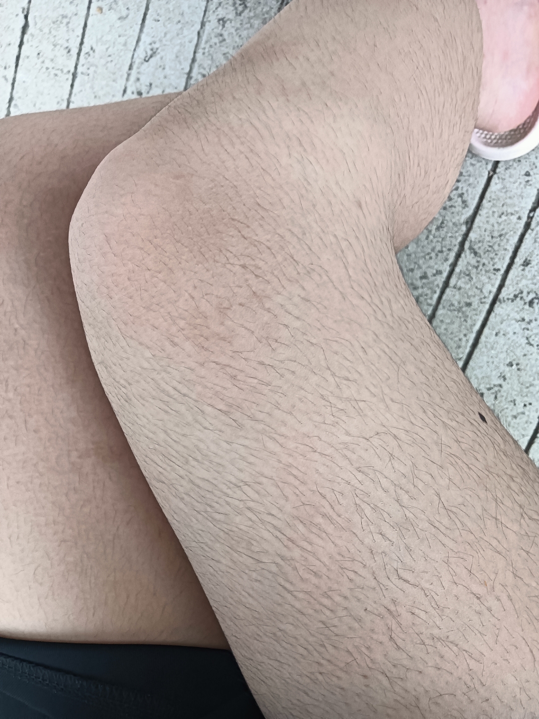 请教各位这种腿怎么办,脱毛膏用过了不管用,腿毛又密又粗[惊恐] ,有