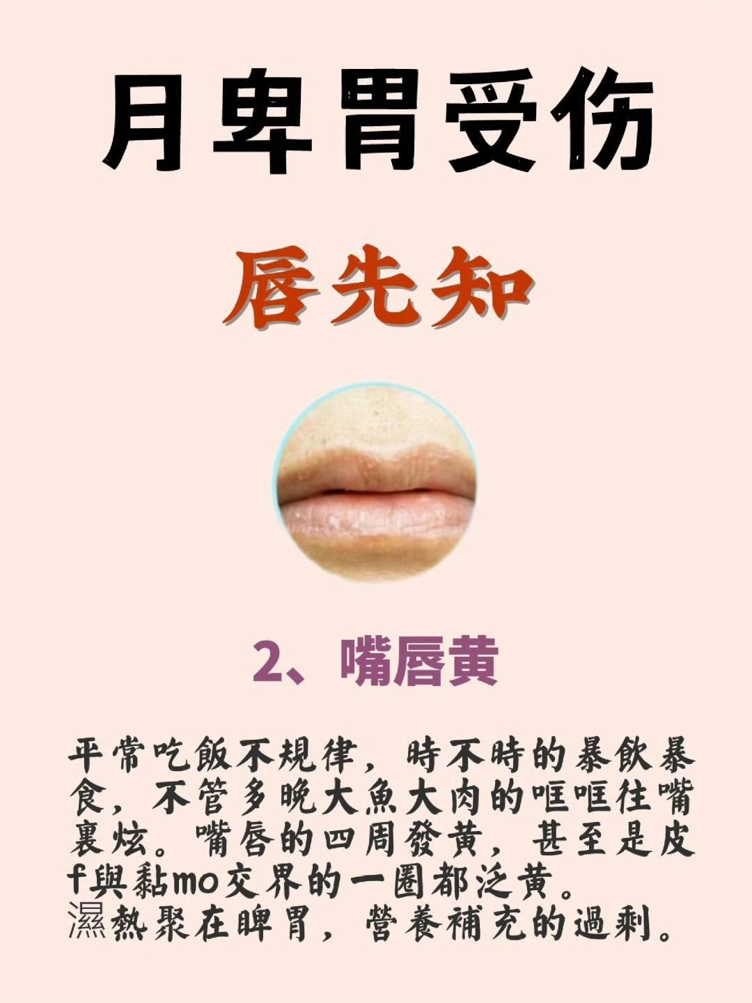 多看看嘴唇说不定就有答案 1嘴唇爆皮 2唇黄 肾虚的嘴唇唇四白的准确