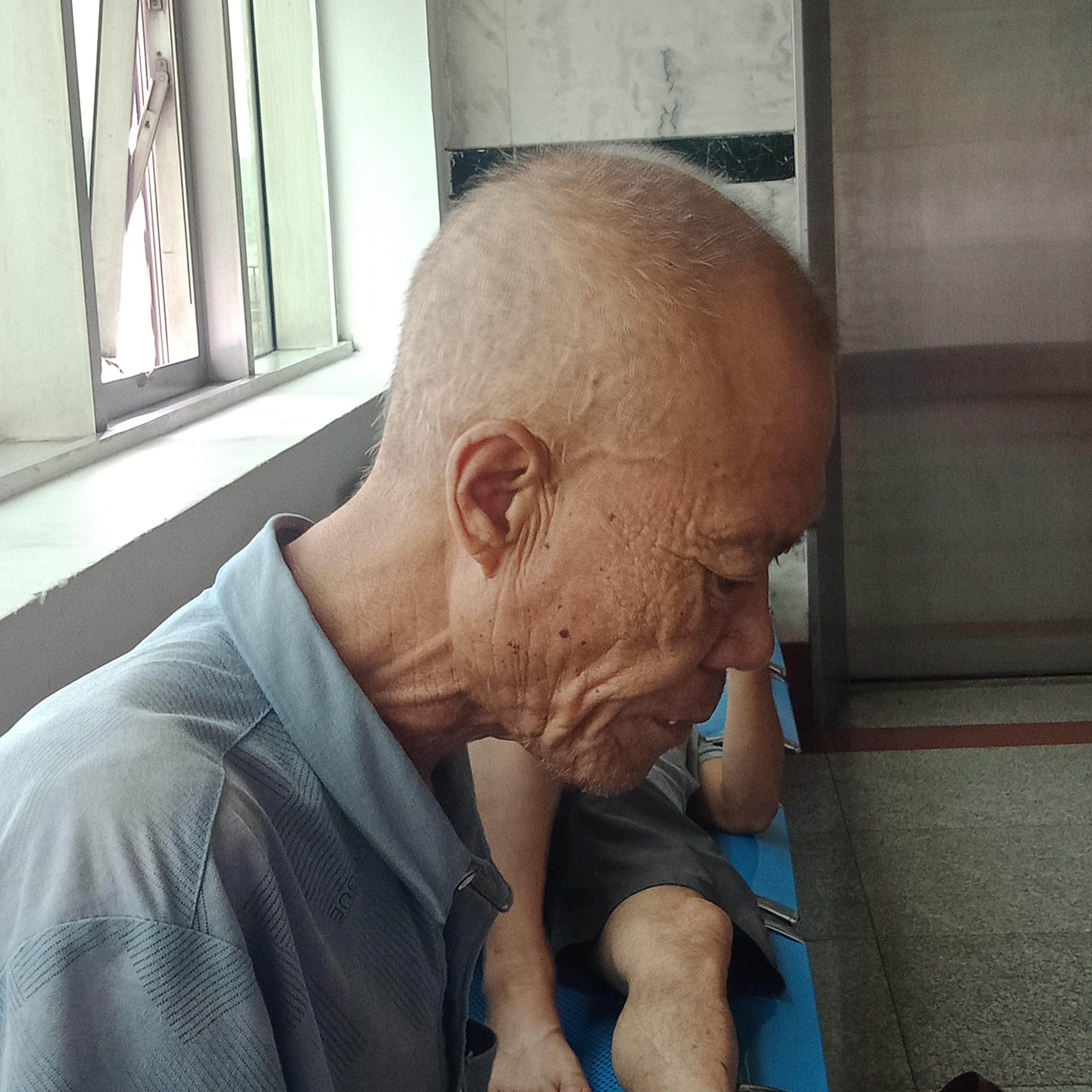 化疗前后对比,化疗之后身体更差了