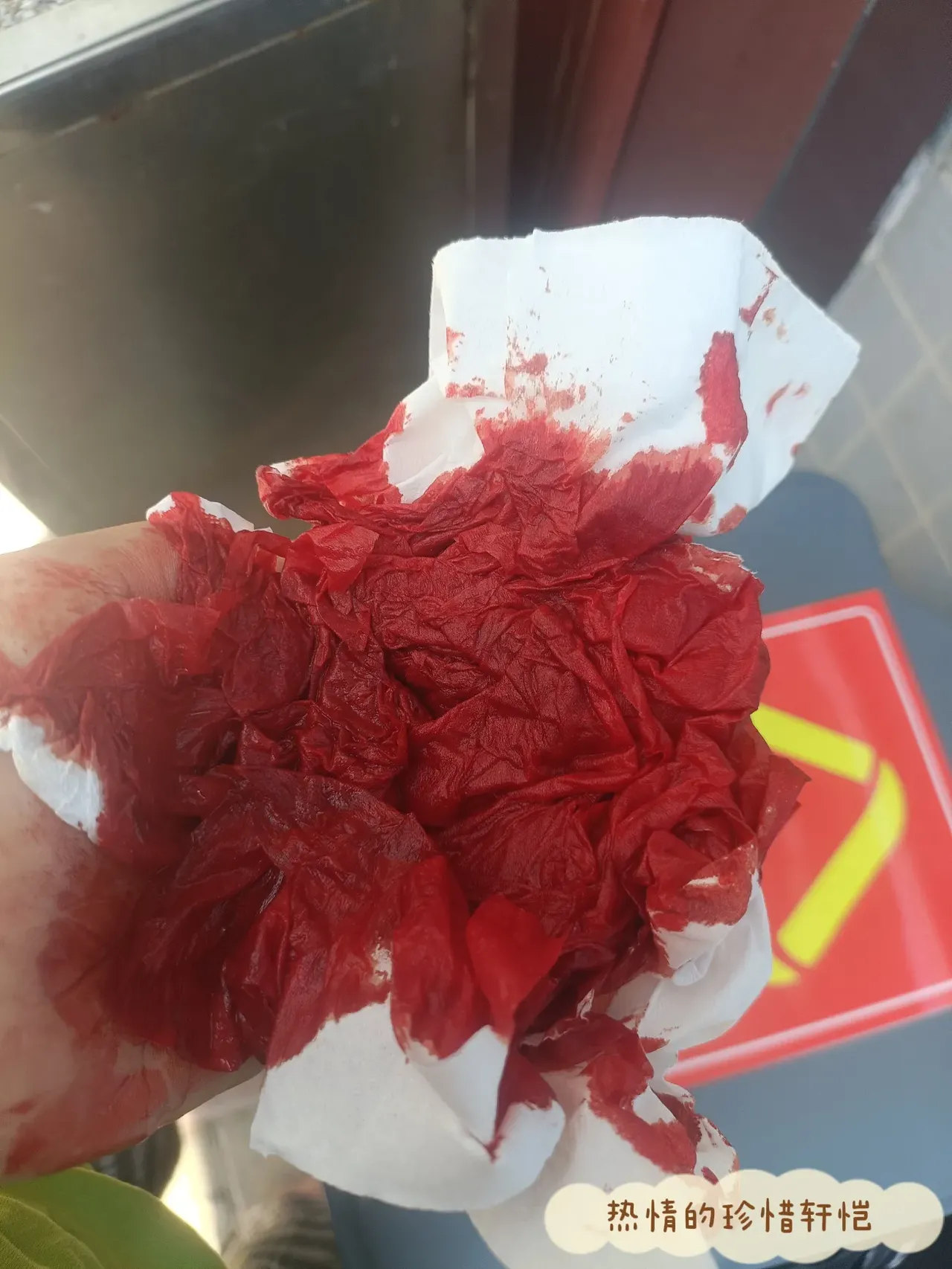 脚上的伤口一直在流血,怎么都止不住,好不容易来到医院,来到医院的