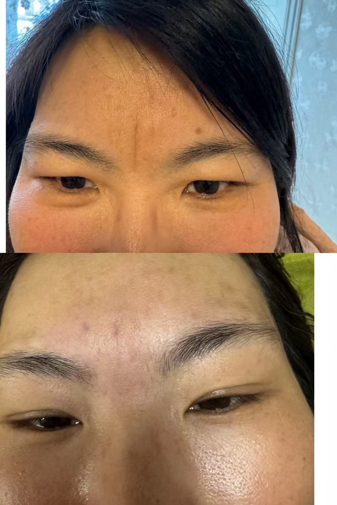 印堂悬针纹不但伤自身, 它会影响财运和子女发展 3