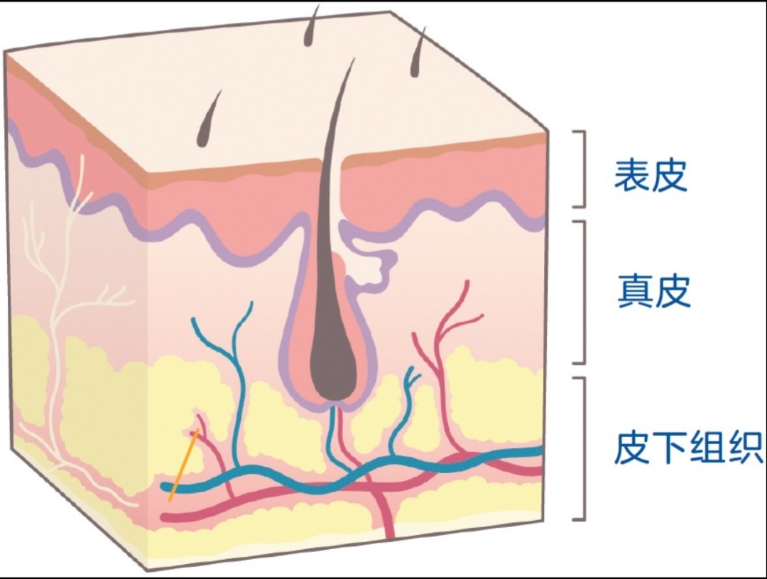 皮下图片图片