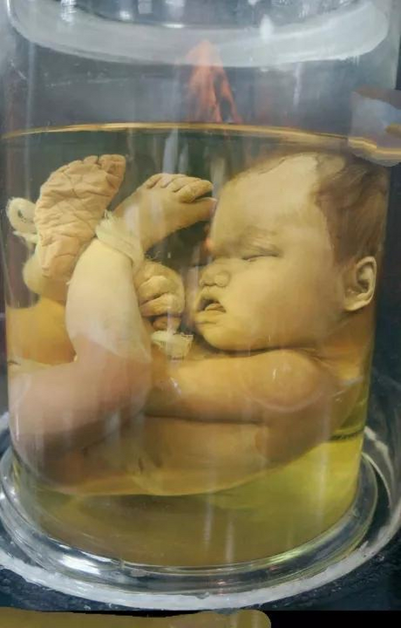 婴儿标本解剖图片