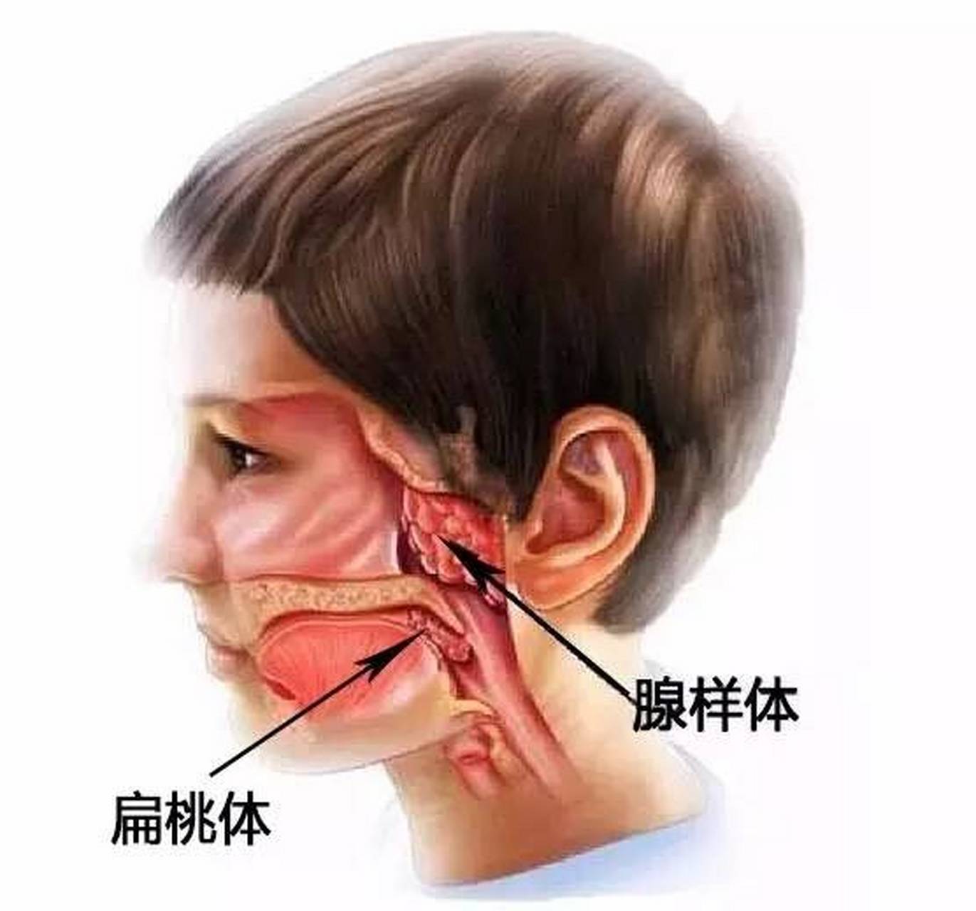 切除扁桃体或者是腺样体,对宝宝的免疫力会 对于扁桃体和腺样体的手术